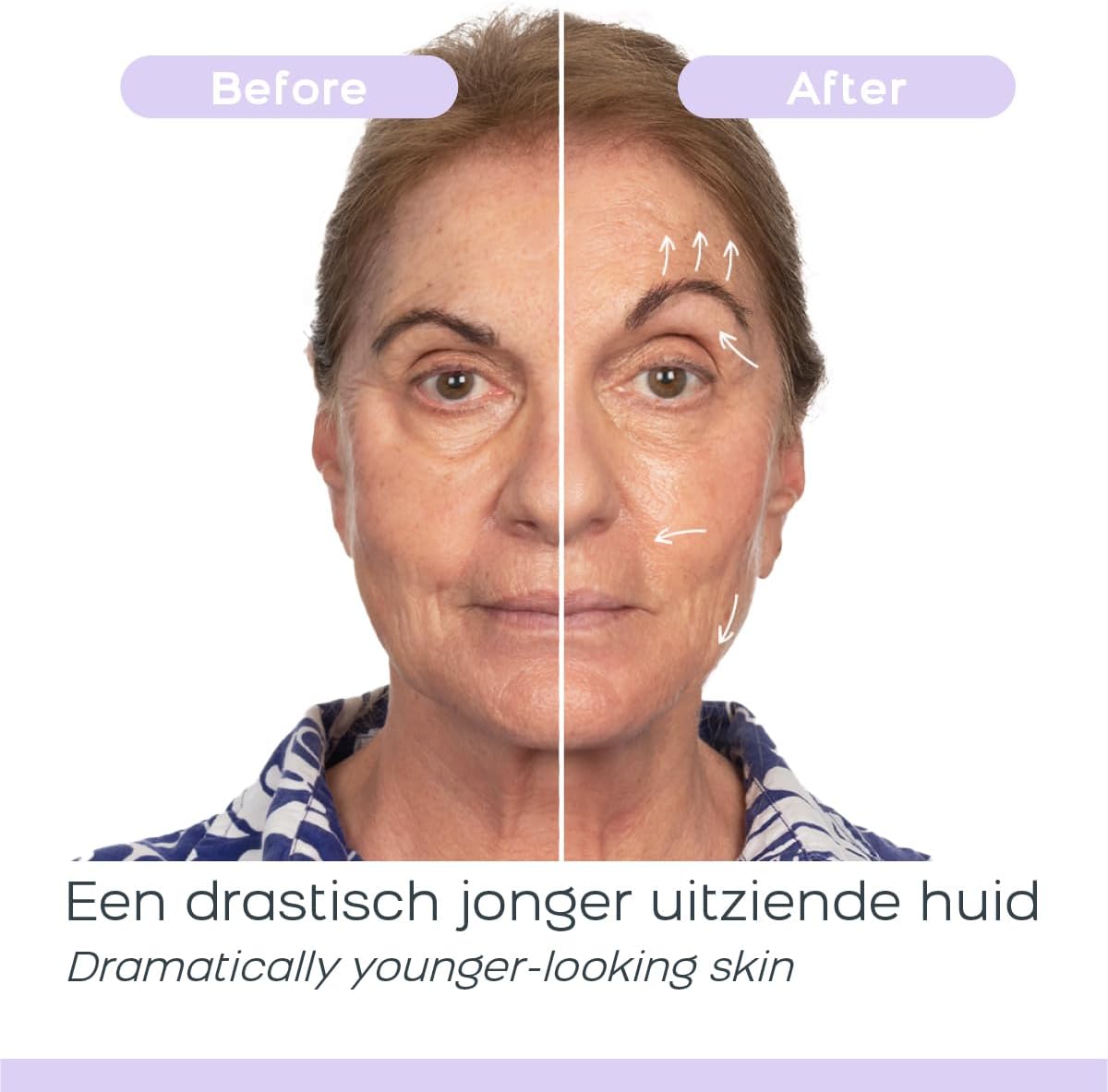 Dermawand Pro Skin Care Device