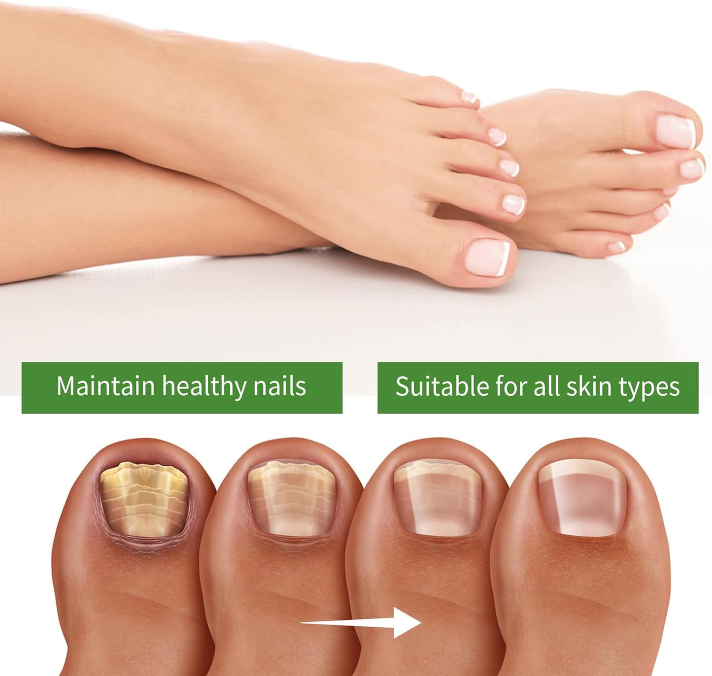 Iouyjiu Nail Strengthener Toenail Care Repair Cracked Nail Hydrating Formula Organic Ingredients 1 Stick Ideal for Fast and Effective Reliefs Home Use 10ml