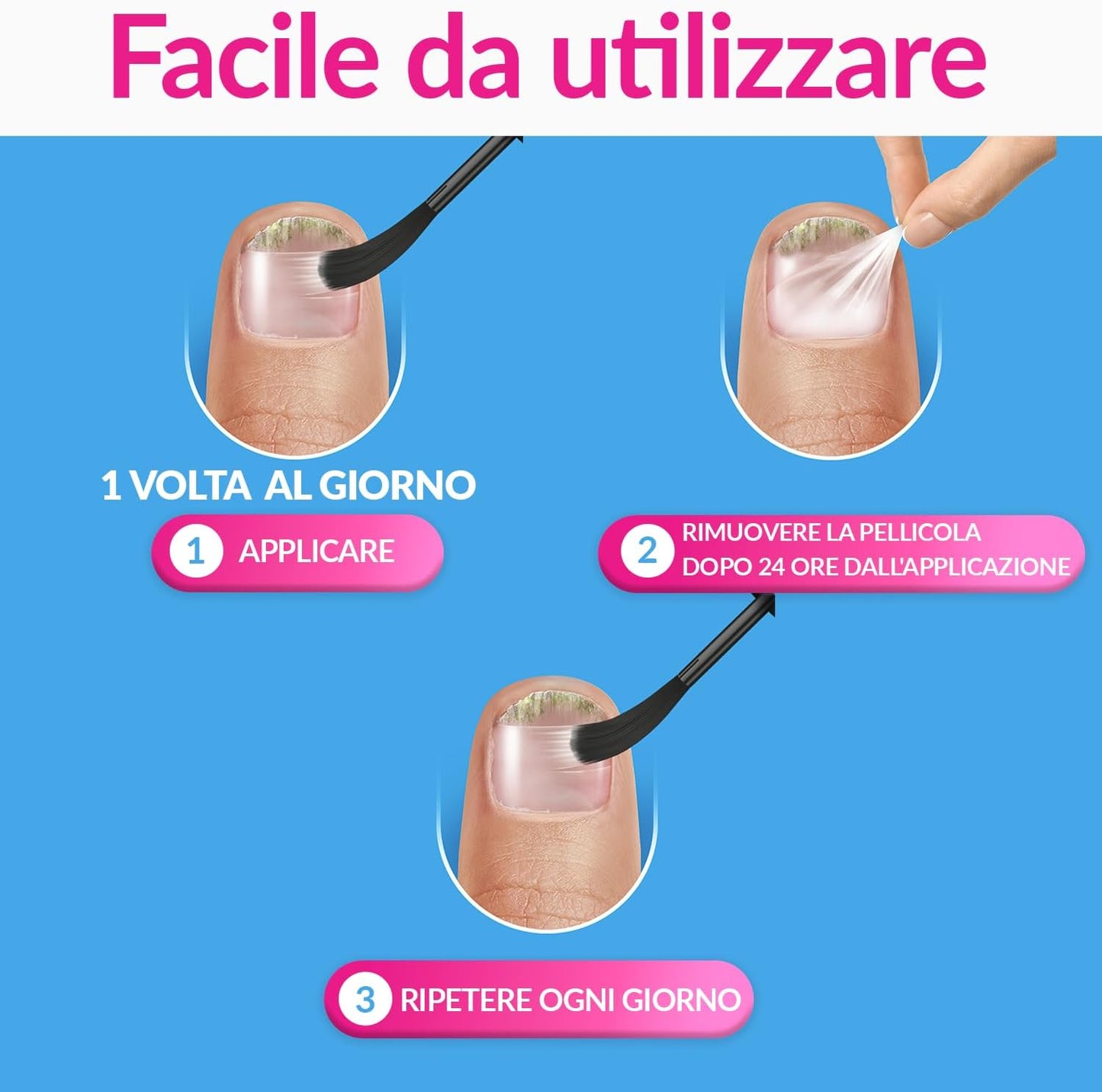 Excilor FORTE Nail Mycosis - TransActive+ Technology for Mild or Advanced Mycoses for Healthier and Stronger Nails - 30ml