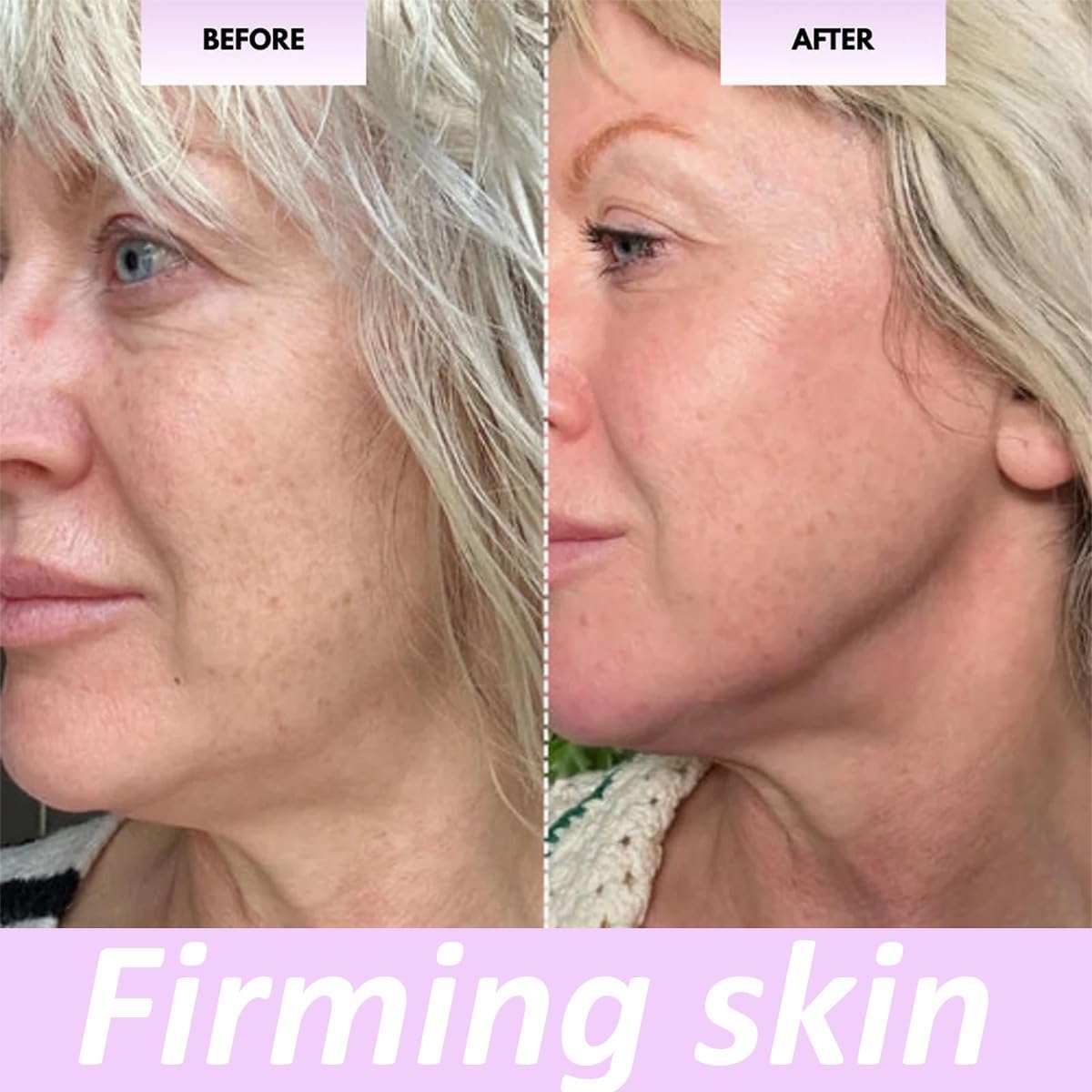 Rullo Di Bellezza Elarique, Rullo for Il Viso Glow Sculpt, Rullo Di Bellezza, Strumento Di Massaggio for Il Viso Con 24 Pietre Di Tormalina, Rullo in Lega Di Alluminio for La Luminosità Di Viso