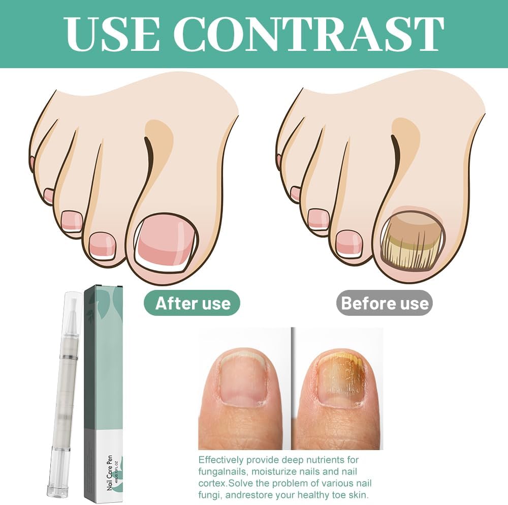 HIULLEN Nail Care Pen, 4 Pieces Nail Care Routine Nail Care Tool for Nail Care and Toenails