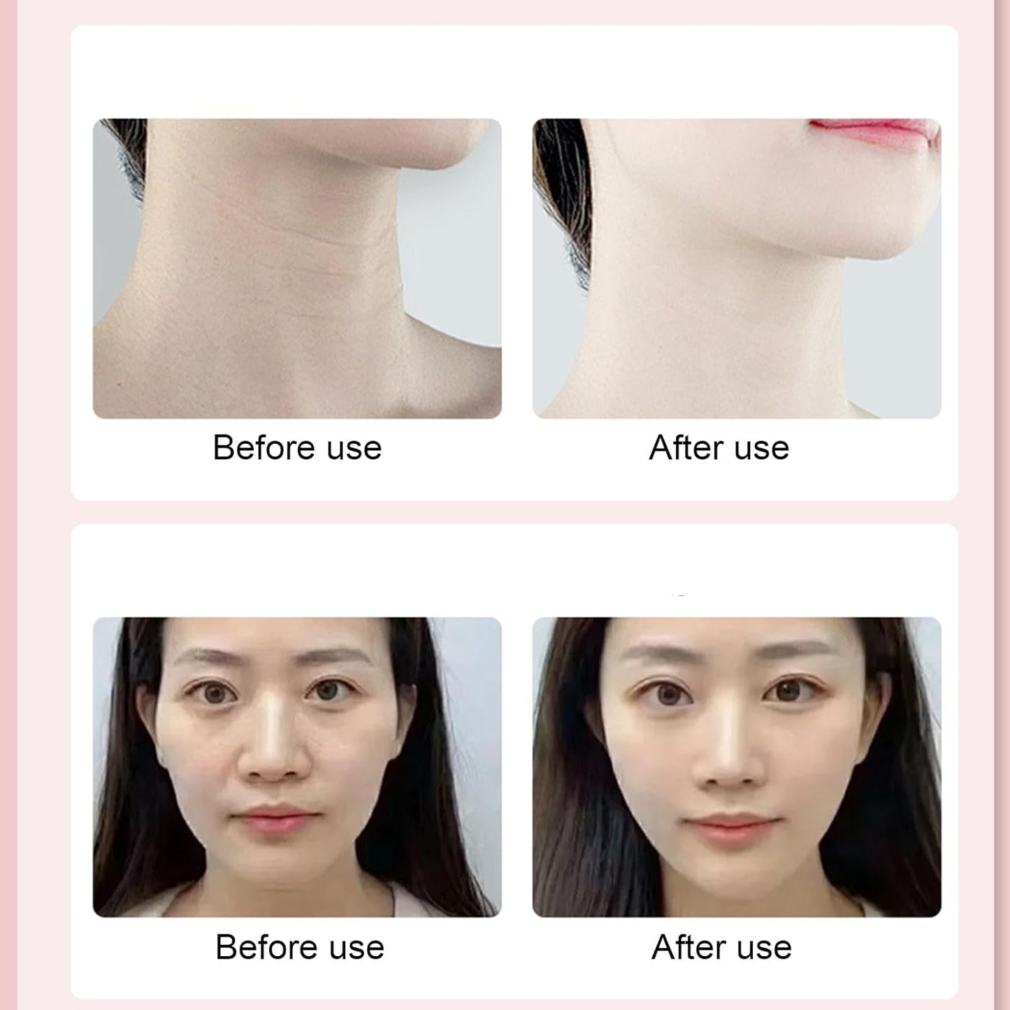 Face and Neck Massager, Neck Tightening Device, Electric Facial Massager, Neck Tightening Device, Face Neck Massager, Skin Care Tool for Women