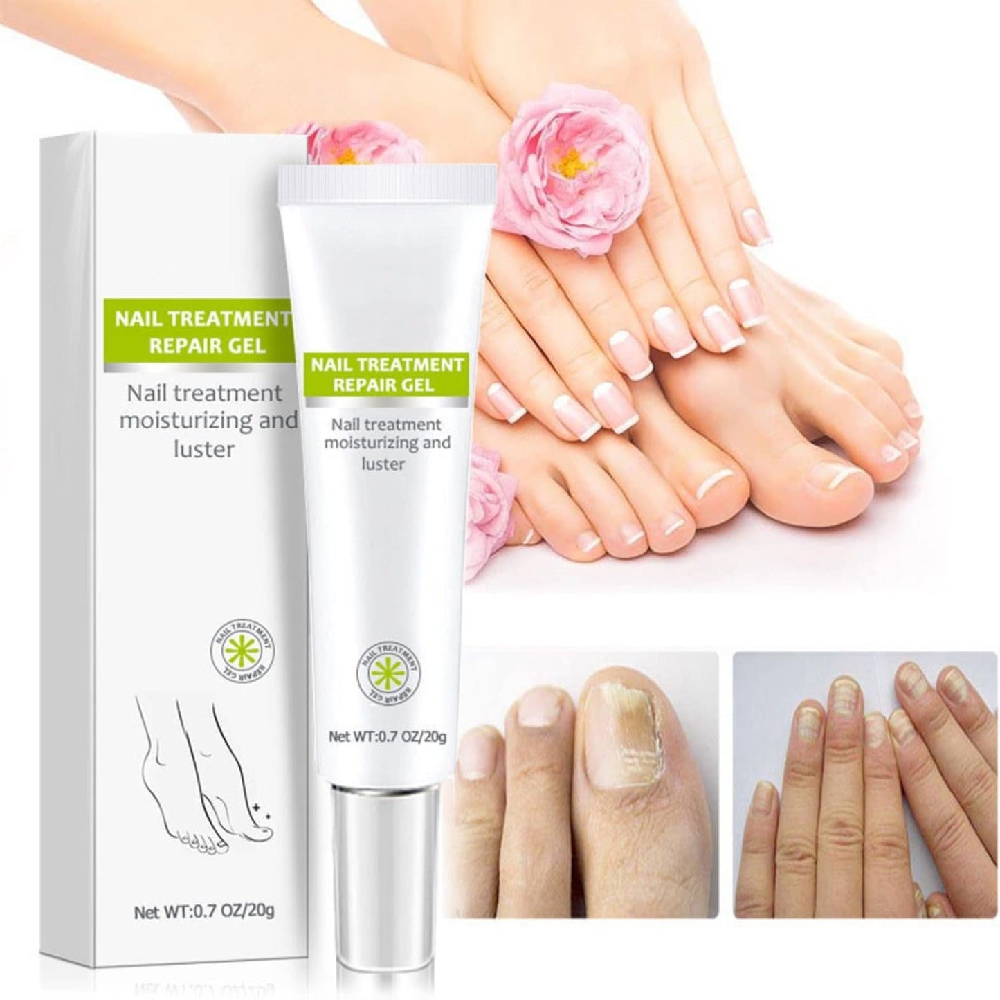 2PCS Nail Treatment Repair Gel, Fungal Nail Treatment Nail Repair Gel, Toe Be Health Instant 7 Days Beauty Gel, Toenail Treatment & Cure Under the Nail, for Damaged Nail.