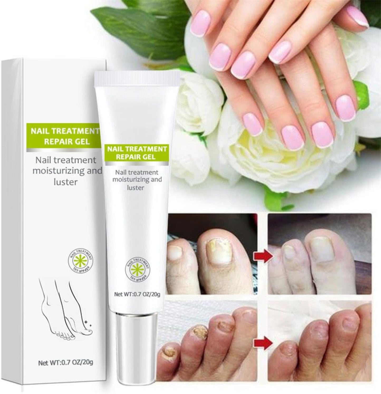 2PCS Nail Treatment Repair Gel, Fungal Nail Treatment Nail Repair Gel, Toe Be Health Instant 7 Days Beauty Gel, Toenail Treatment & Cure Under the Nail, for Damaged Nail.