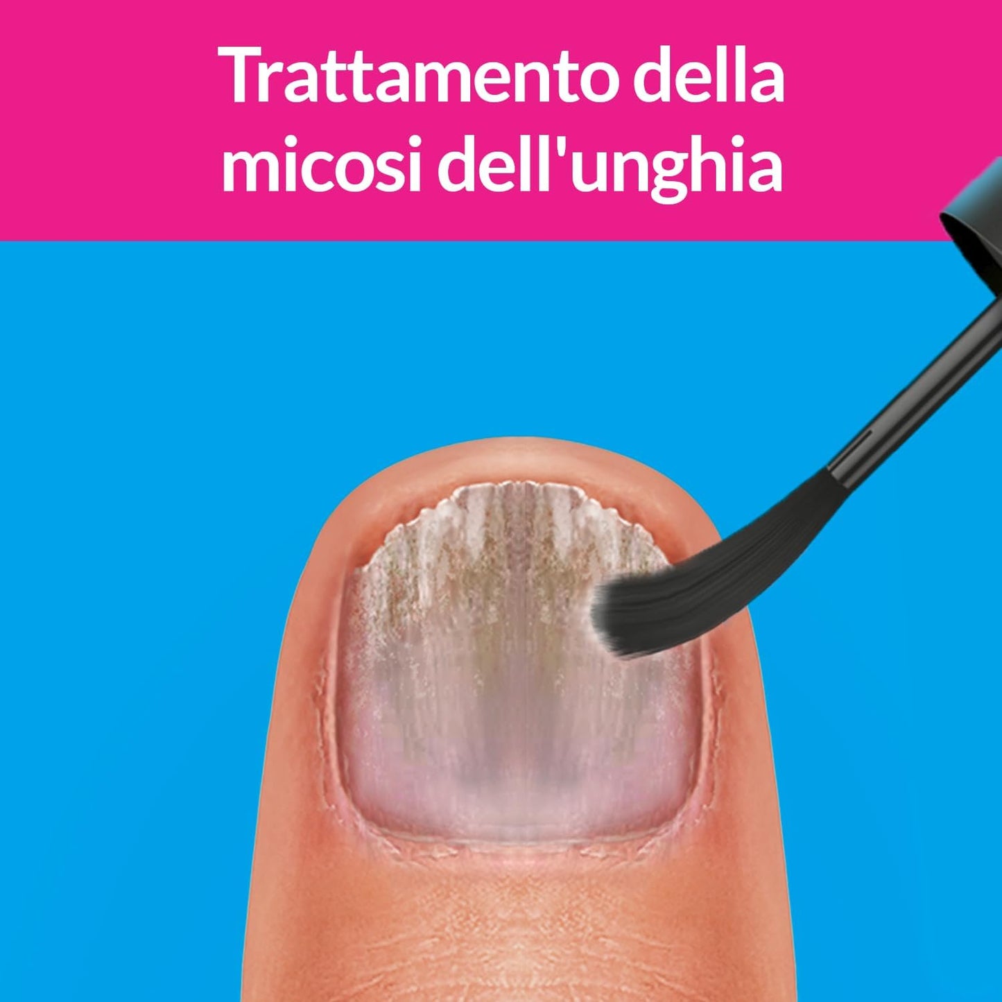 Excilor FORTE Nail Mycosis - TransActive+ Technology for Mild or Advanced Mycoses for Healthier and Stronger Nails - 30ml