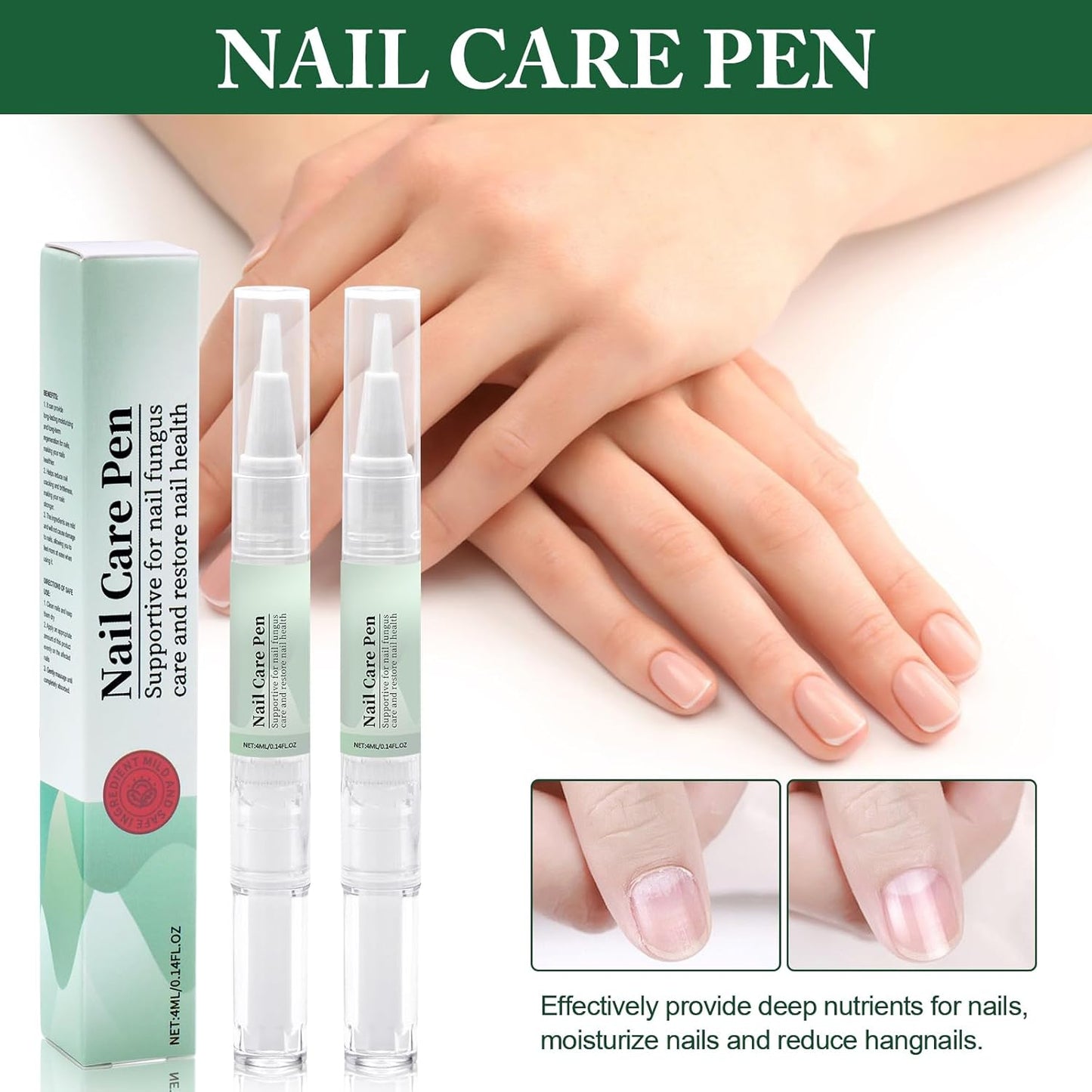 2 x Nail Care Pens with Tea Oil, Vitamin E and Aloe Vera - For Broken Nails