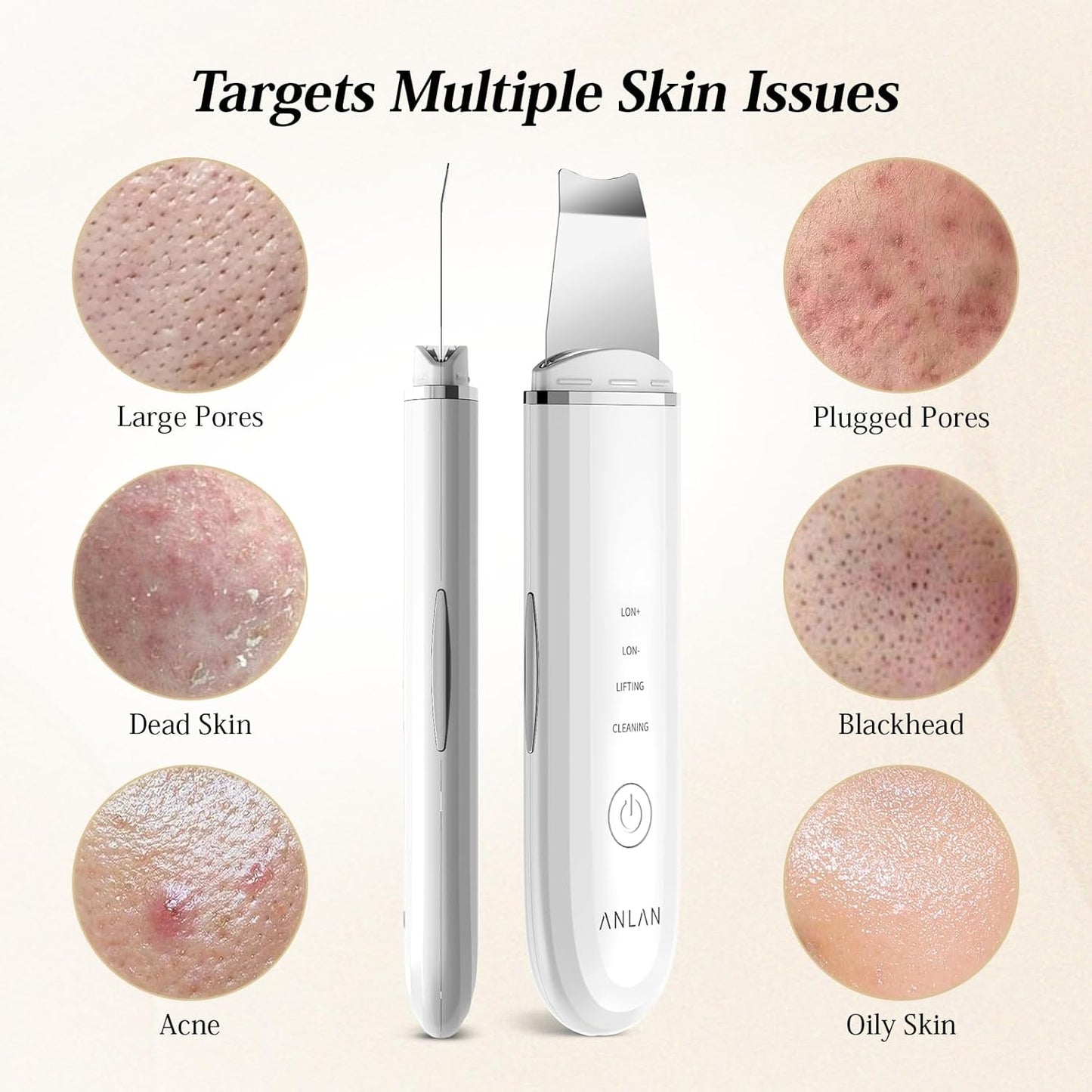 ANLAN Professional Ultrasonic Skin Scrubber for Deep Cleansing Face Peeling and Care, 4 Modes Blackhead Removal, USB Rechargeable