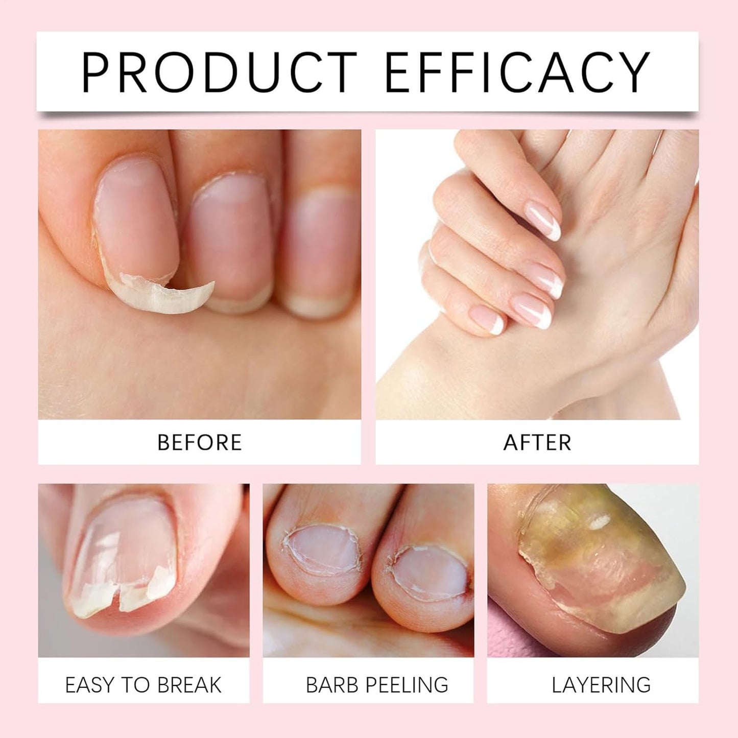 Nail Strengthening Oil - Nail Nutritionist - Growth Cuticle Oil and Strengthening Repair for Women and Girls Daily Care Salon Home