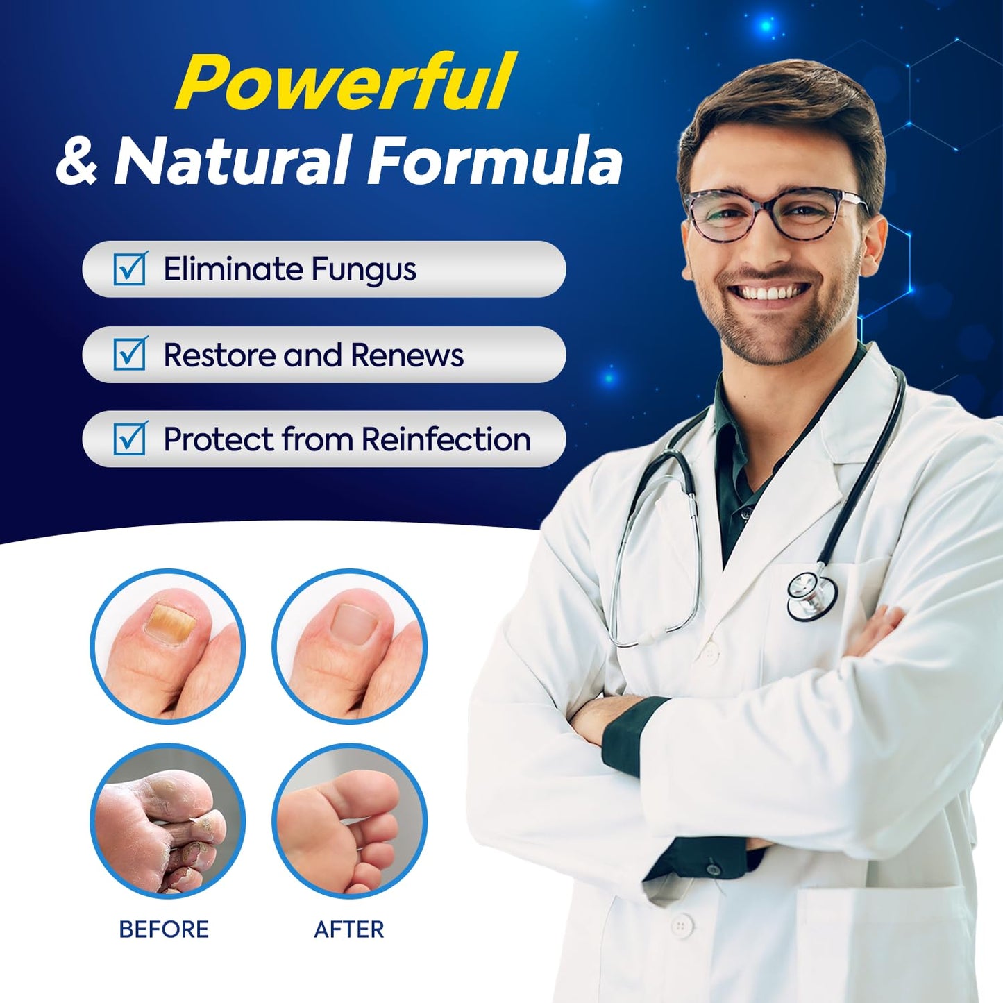 Toenail Fungus Treatment with 25% Undecylenic Acid, Toe Fungus Treatment for Toenail, Fungus Nail Treatment, Toenail Fungus Treatment Extra Strength, Fungal Nail Treatment for Athletes Foot (1oz)