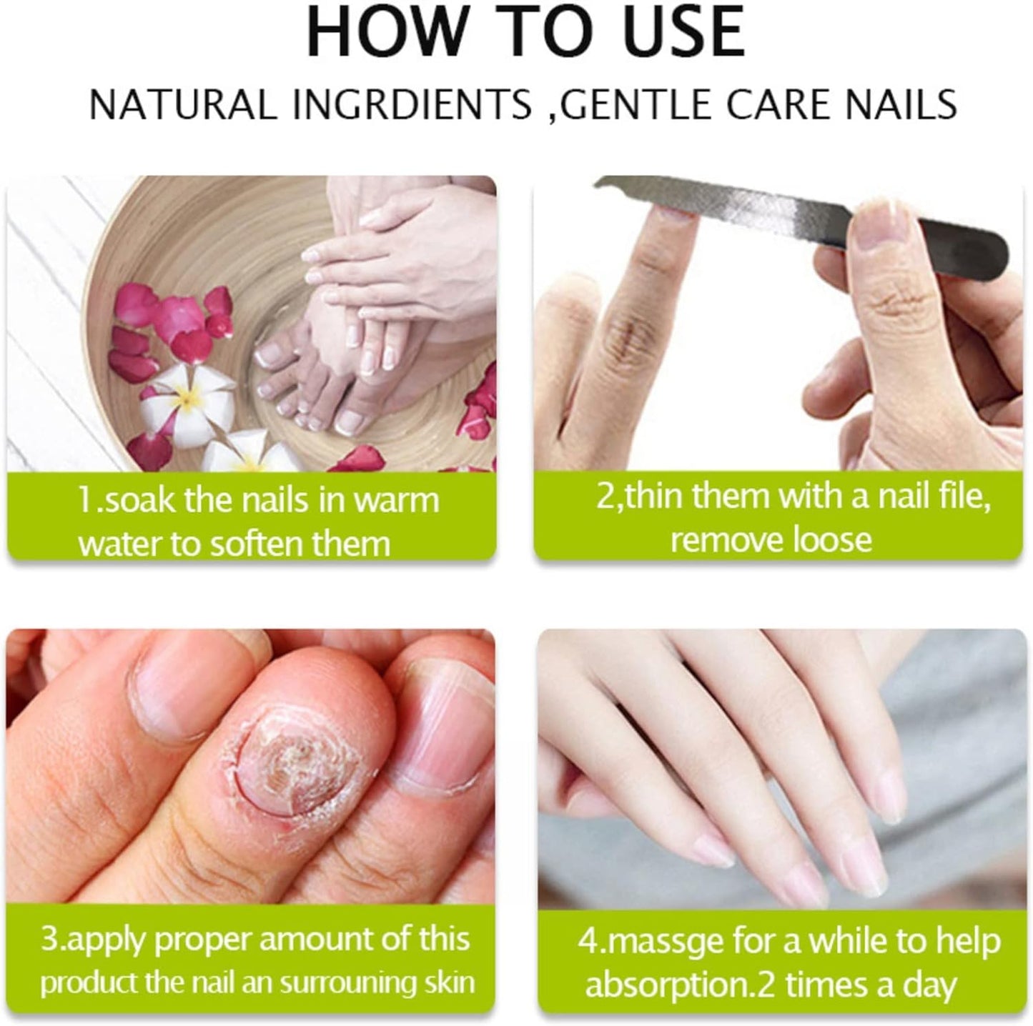 2PCS Nail Treatment Repair Gel, Fungal Nail Treatment Nail Repair Gel, Toe Be Health Instant 7 Days Beauty Gel, Toenail Treatment & Cure Under the Nail, for Damaged Nail.