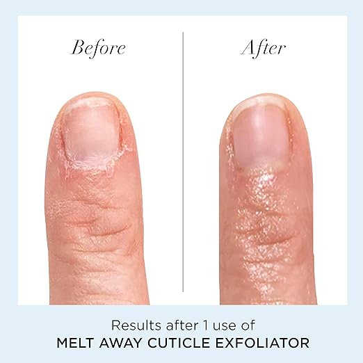butter LONDON Cuticle Remover Liquid, Melt Away - Cuticle Softener Oil Exfoliator Gently Removes Dry & Overgrown Skin - Nail Care for Clean & Healthy-Looking Nails, Home Manicure & Pedicure