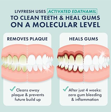 Toothpaste Gel, Clinically Proven to Remove Plaque 250% Better, Improves Gum Health 190% Better, Prevents & Reduces Tartar, Freshens Breath, SLS Free Dental Gel, Wintergreen, 2 Pack