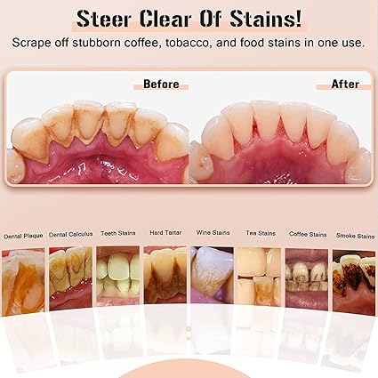 Plaque Remover for Teeth, Electric Tooth Cleaner Tartar Remover for Teeth with LED Light,4 Modes Rechargeable Teeth Cleaning Kit with Dental Tools, 2 Replaceable Heads (White A)