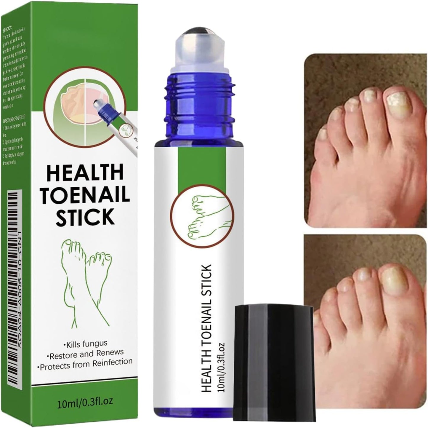 Nail Care Liquid, Extra Strength Nail Strengthener Roller, 0.71x0.71x3.23 inches Adorable Compact Gentle Soothing Toenail Cares Supplies for Adults Family, Restoring Comfort