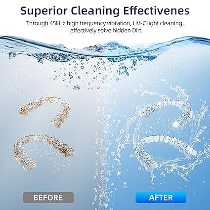 Ultrasonic Retainer Cleaner, Retainer Cleaner for Dentures, Mouth Guards, Braces, Toothbrush Heads, Jewelry with UV-C Cleaner, 45kHz Ultrasonic, 4 Mode Ultrasonic Cleaner Machine (Black)