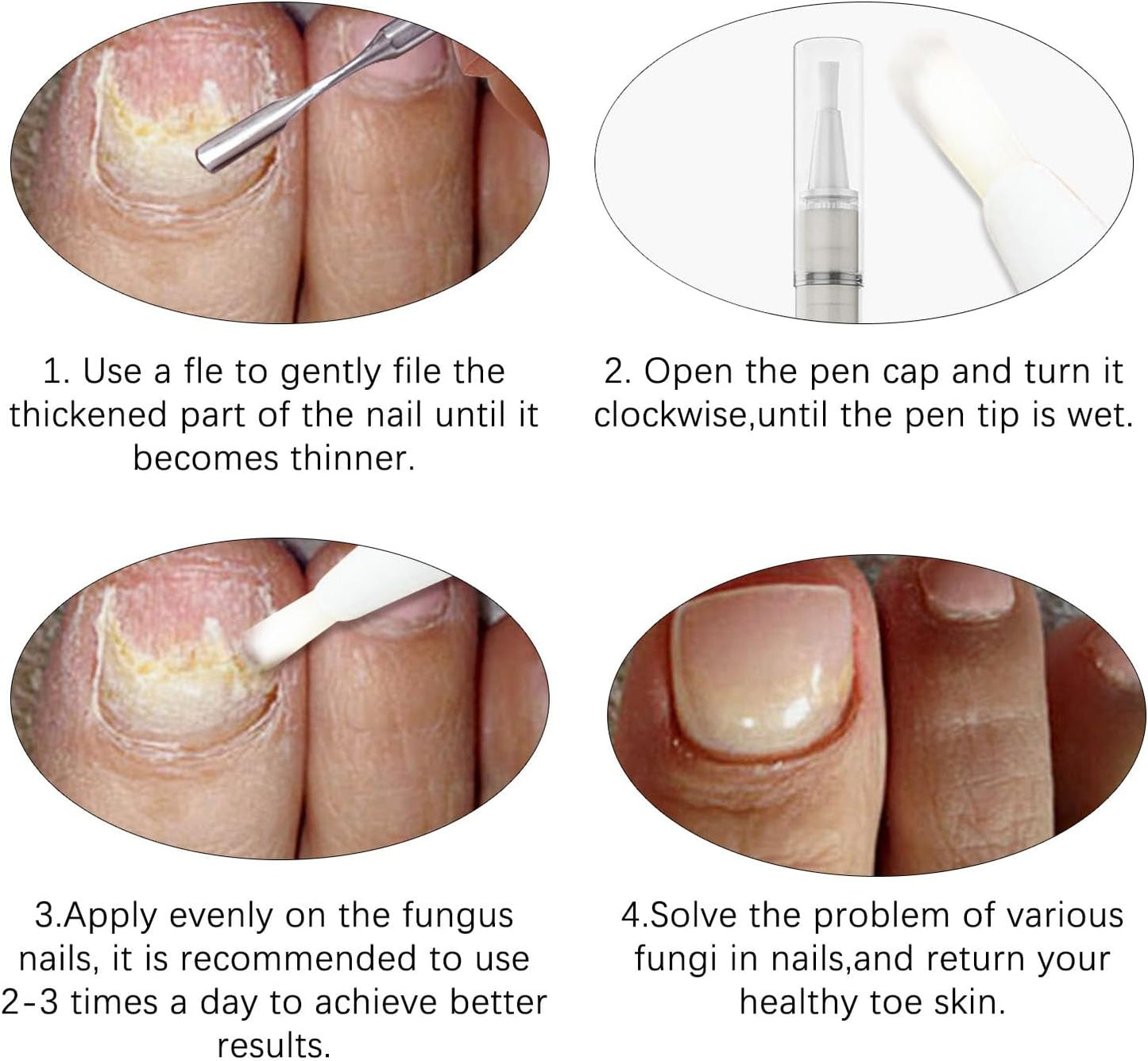 Nail Care Pen, Broken Nail Repair, Nail Care Pen, Nail Repair Pen