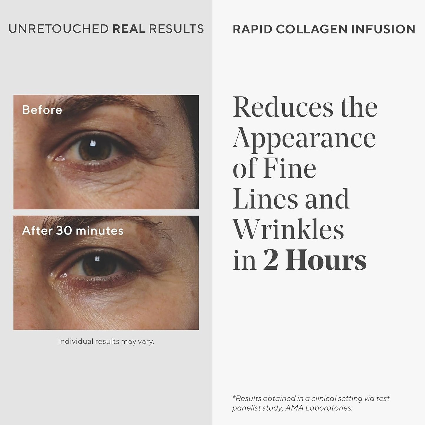 Murad Resurgence Rapid Collagen Infusion - Anti-Aging Collagen Serum for Skin - Collagen Cream for Face and Neck Smooths and Visibly Minimizes Wrinkles, 1.0 Fl Oz