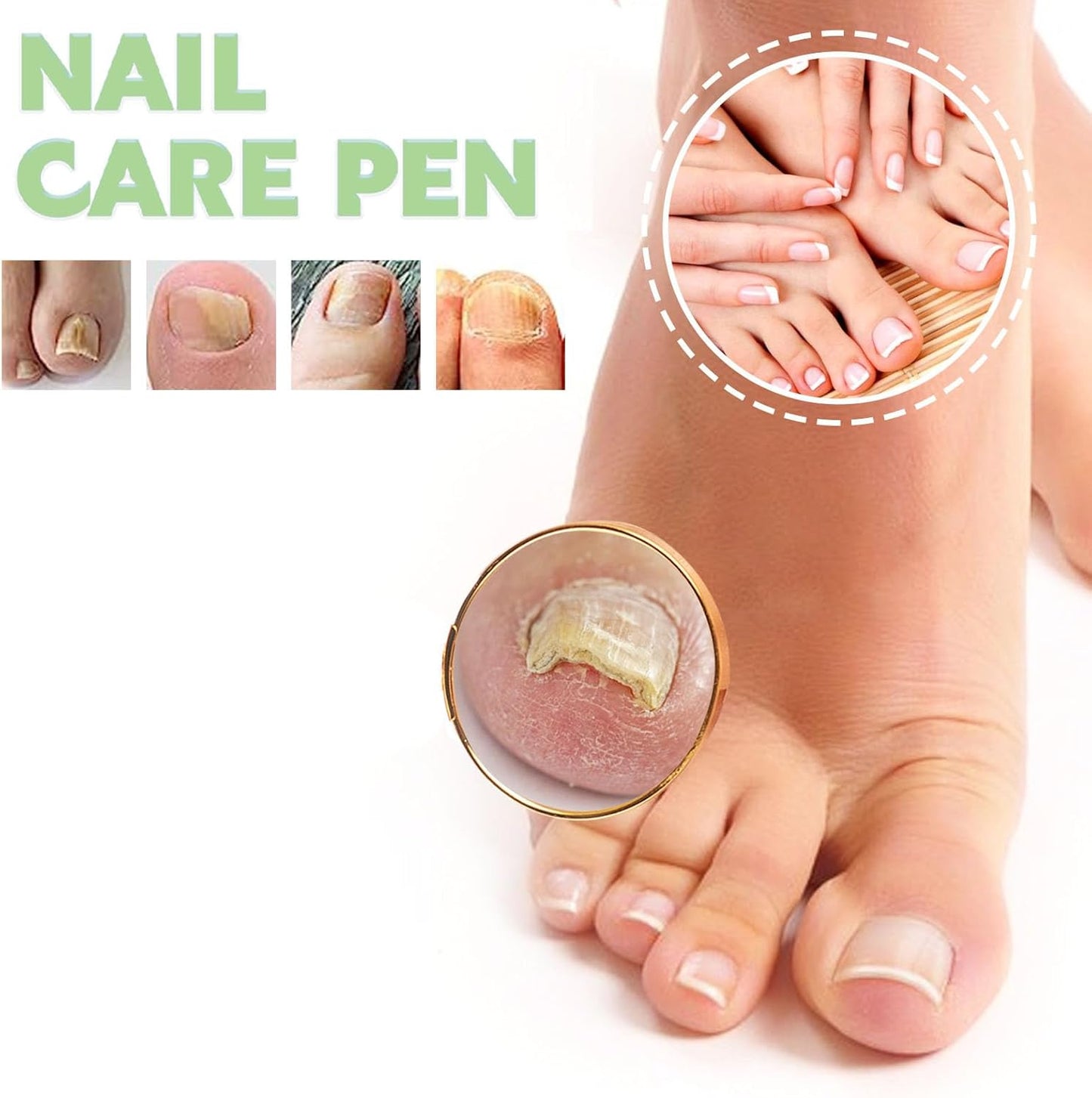 Nail Care Pen, Broken Nail Repair, Nail Care Pen, Nail Repair Pen
