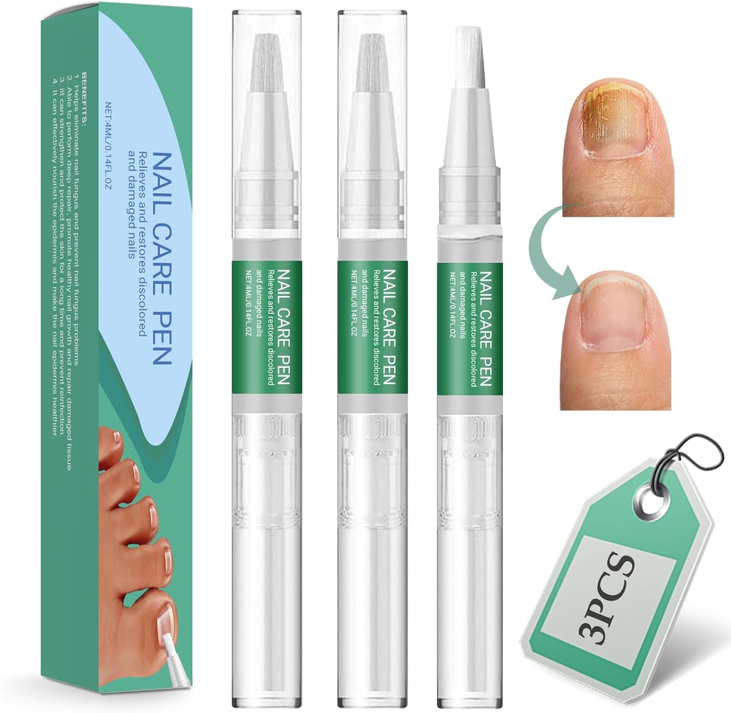 3 Pieces Nail Care Pen, Nail Treatments, Nail Care, Soothes, for Nails and Nails