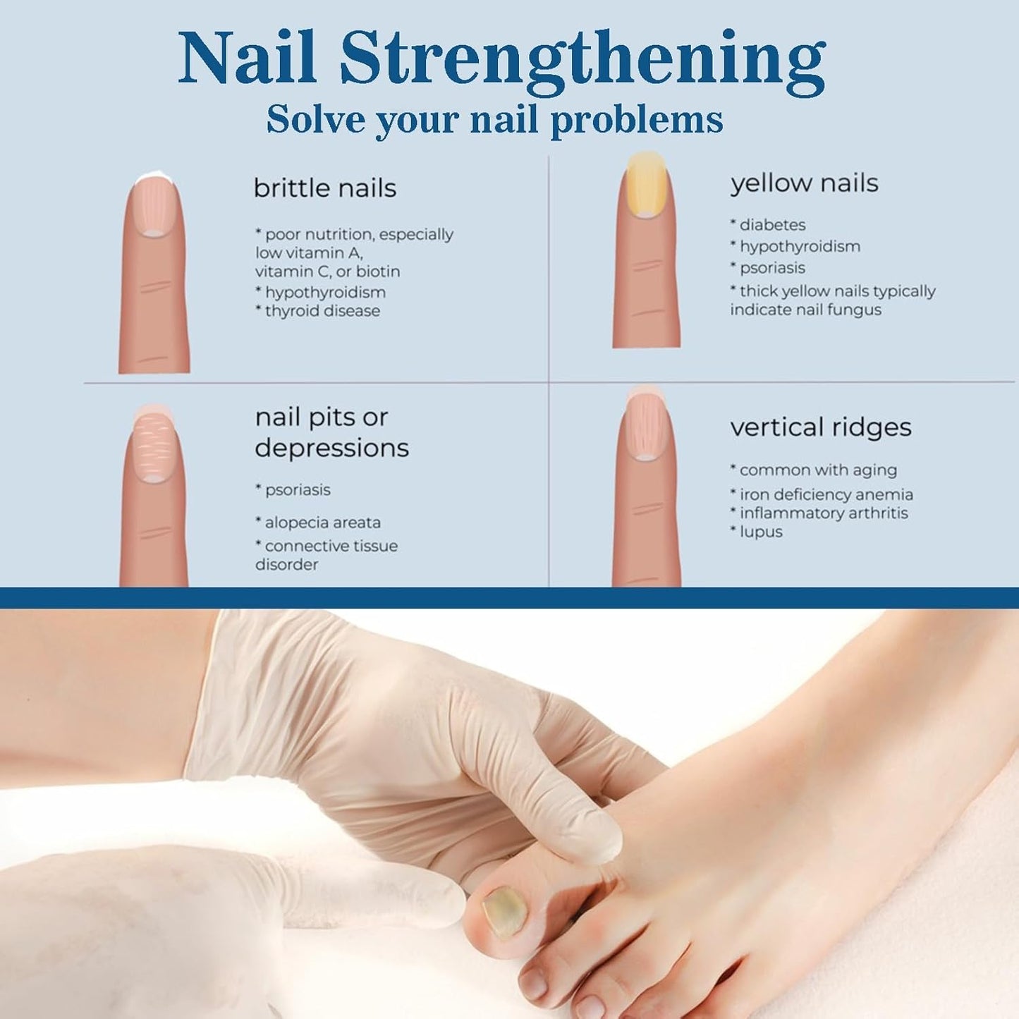 4 Pcs Nail Care with Nail File, Cuticle Oil, Nail Care Pencil with Aloe Vera for Nails and Toenails