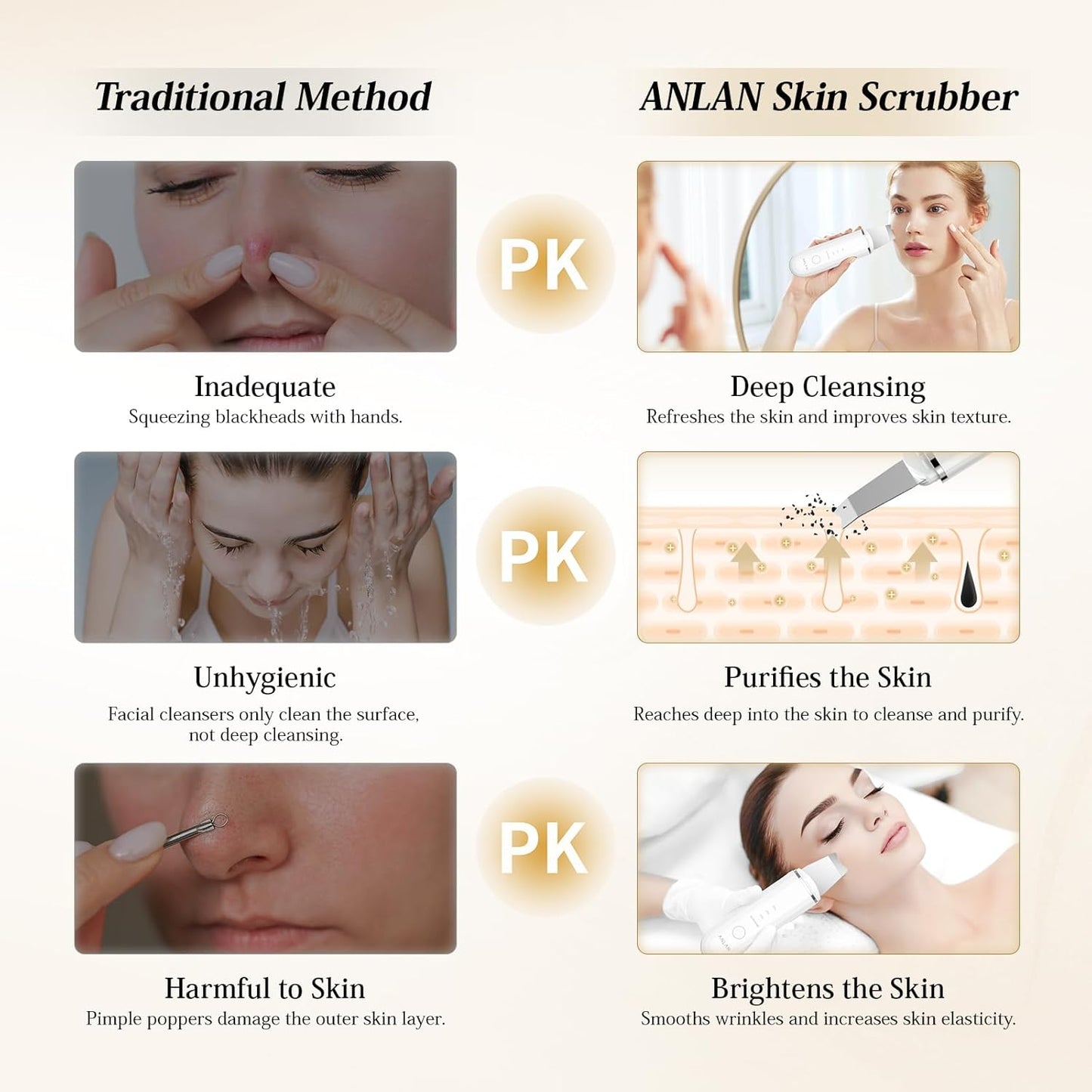ANLAN Professional Ultrasonic Skin Scrubber for Deep Cleansing Face Peeling and Care, 4 Modes Blackhead Removal, USB Rechargeable