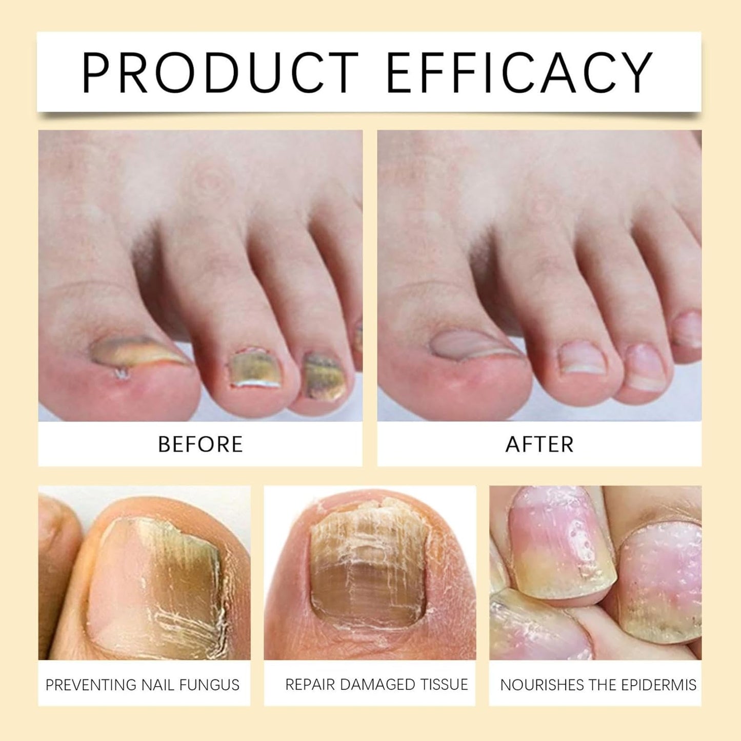 2ml Nail Care Fluid, Strengthen Nails, Smoothes Roughness, Quick Absorption, Long-Lasting Protection(2 Pack)