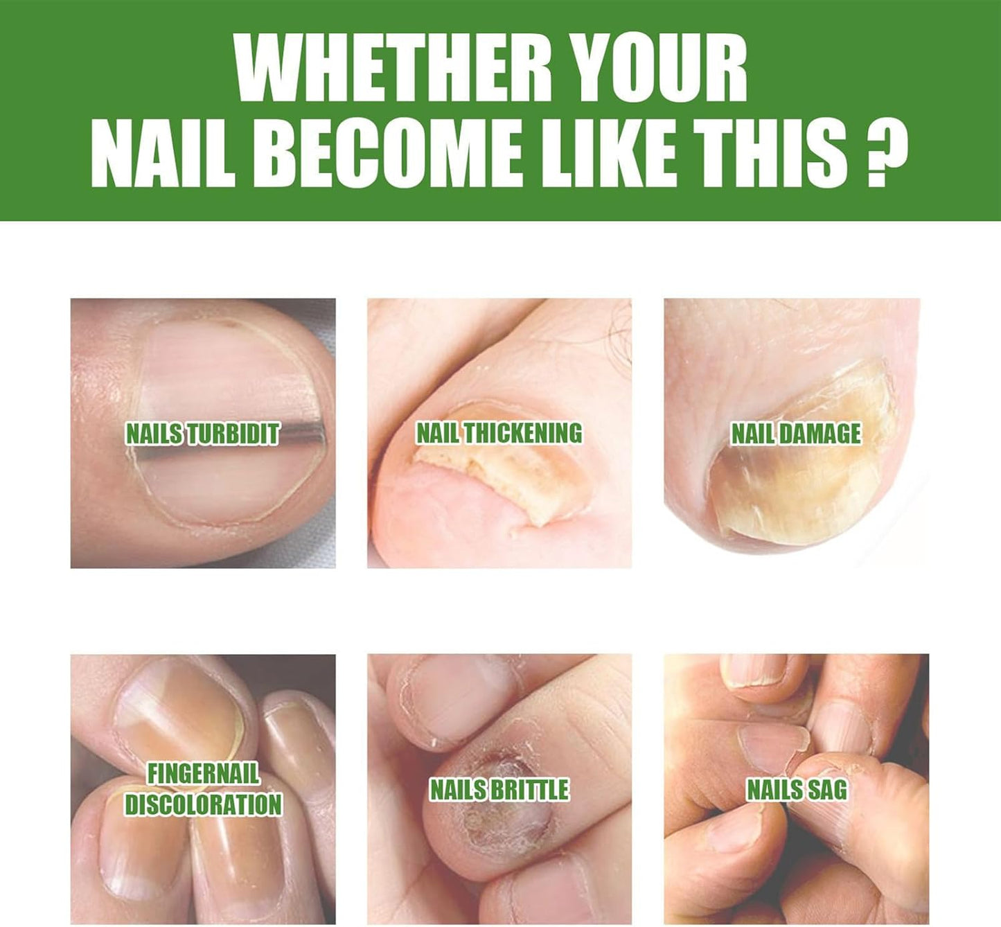Nail Care Liquid, Extra Strength Nail Strengthener Roller, 0.71x0.71x3.23 inches Adorable Compact Gentle Soothing Toenail Cares Supplies for Adults Family, Restoring Comfort