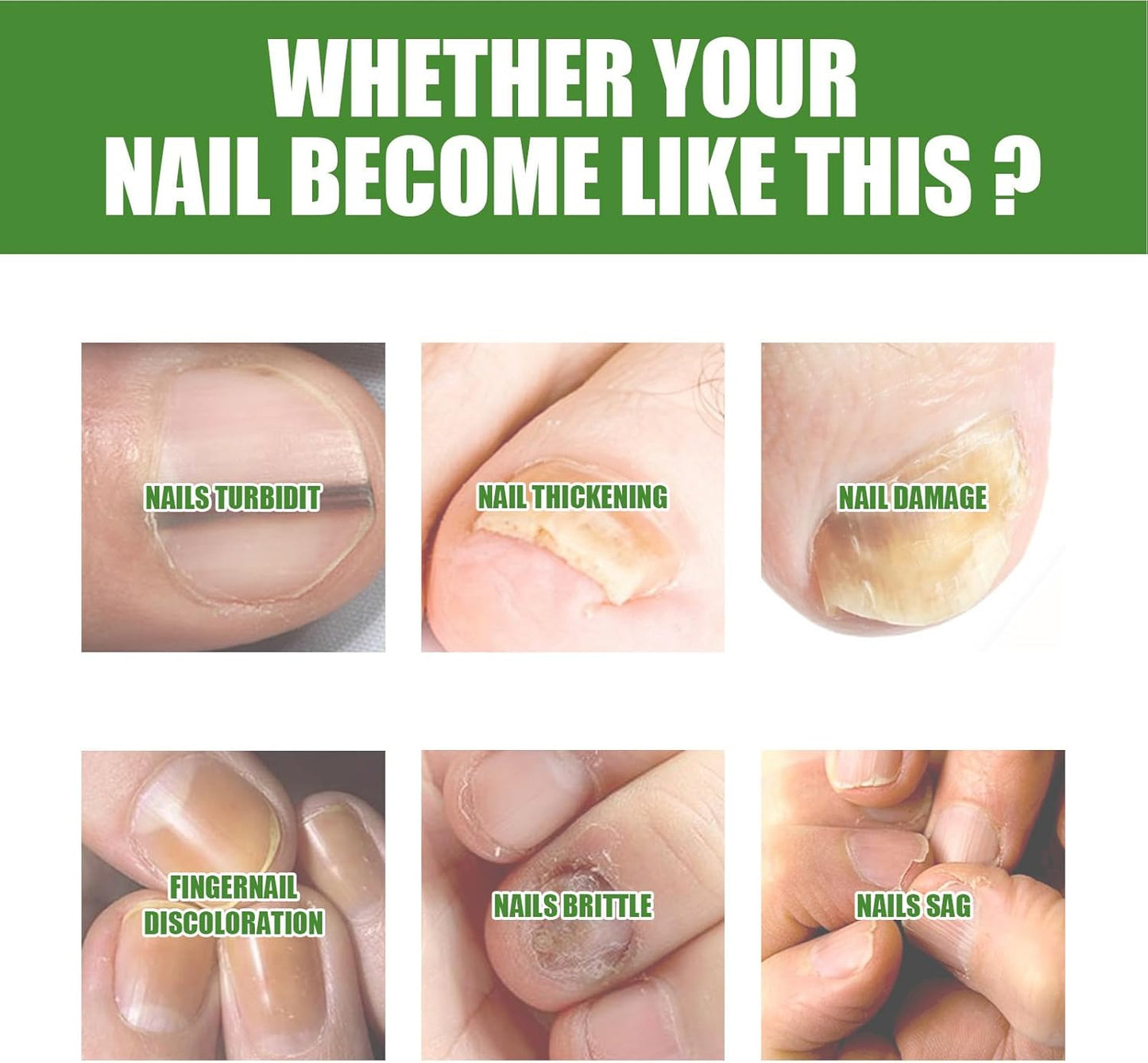 Iouyjiu Nail Strengthener Toenail Care Repair Cracked Nail Hydrating Formula Organic Ingredients 1 Stick Ideal for Fast and Effective Reliefs Home Use 10ml