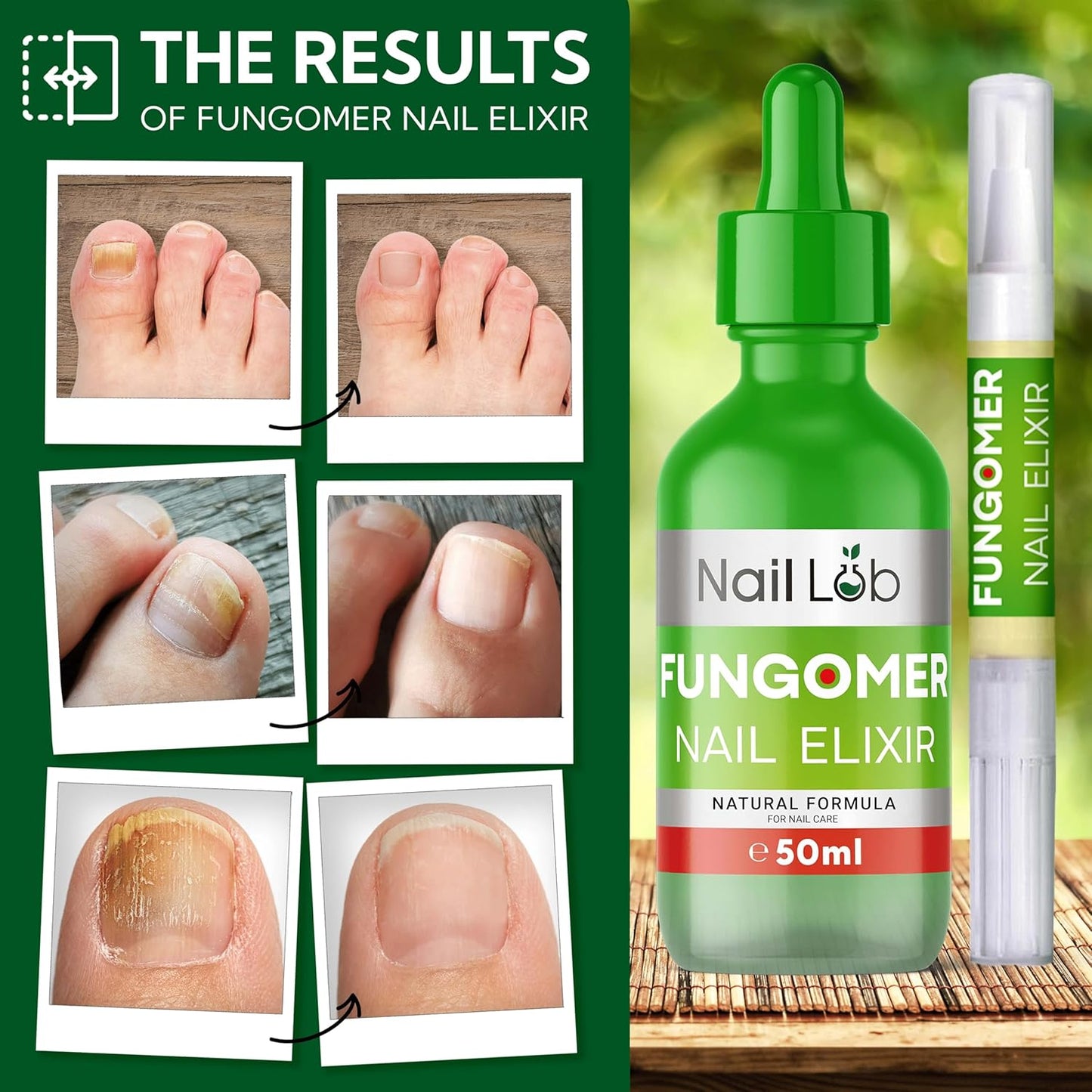 Premium Toenail Fungus Treatment Extra Strength - 50ml - Contains Melaleuca Alternifolia Leaf Oil (Tea Tree), Nail Fungus Treatment Extra Strength for Fingernails - Free 3ml Fungus Pen