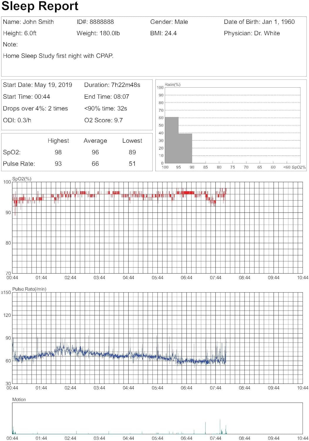 LOOKEE Sleep-Ring Oxygen Tracker with Finger Vibrating Notification for Low O2 Saturation Level, Free Mobile APP Report for Overnight Sleep Insights. for Wellness, Sports, Aviation use only
