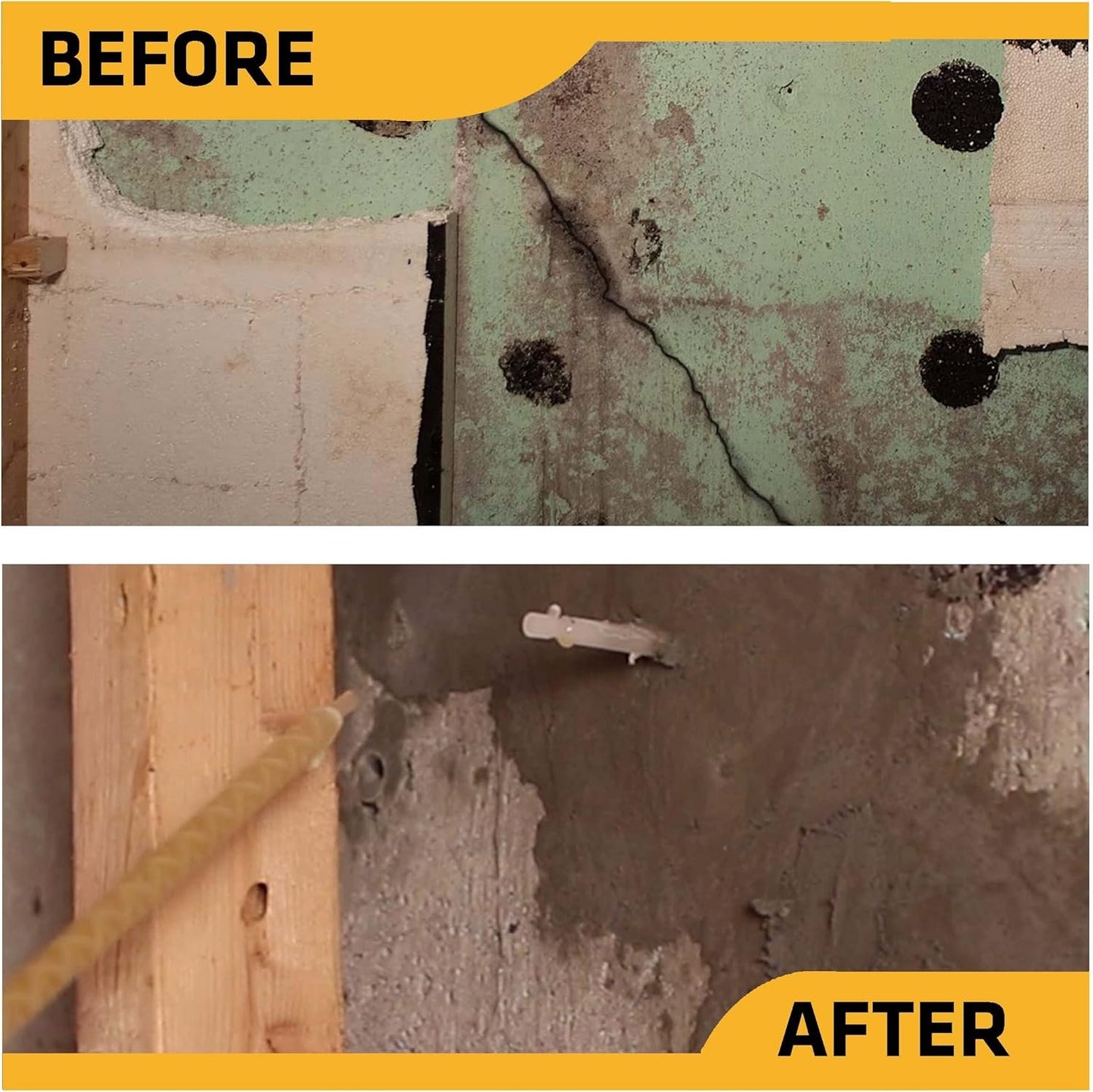 SIKA - Foundation repair - SikaFix Kit - Concrete grey - Injection kit to repair and waterproof cracked foundations - 3-part mortar, injection Ts and grout