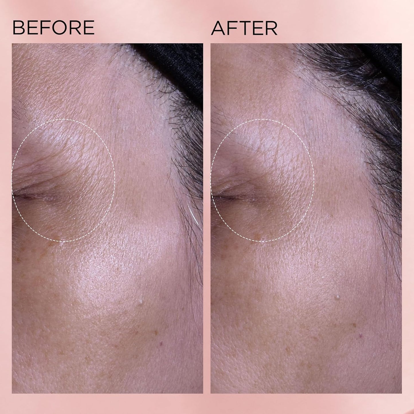 Elizabeth Arden Retinol Serum Wrinkle Filler + HPR Next Generation Retinoid, Ceramide, and Peptide Rapid Skin Renewing Water Day and Night Cream for Face and Neck