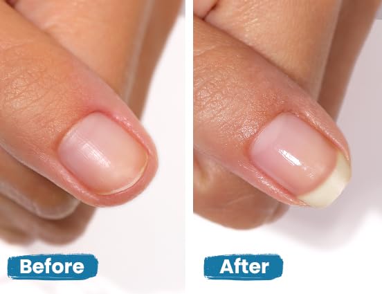 LONDONTOWN Get Strong Nail Hardener - Nail Strengthener Growth Treatment for Damaged Nails, Conditioning Nail Care for Long Healthy Nails, .40fl oz