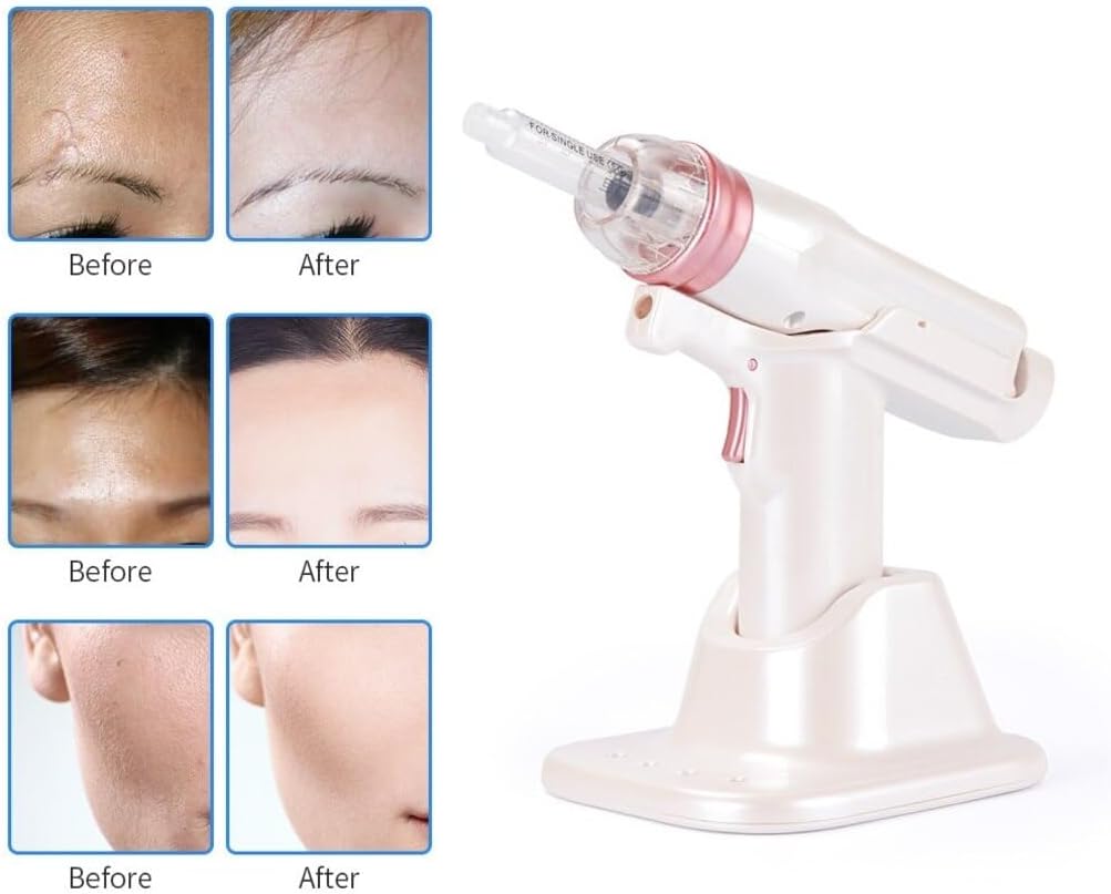 Dr.LPCGF Anti Wrinkle Injection Machine - Water Vacuum Gun - Facial Skin Care Beauty Device for Skin Rejuvenation,Moisturizing,Cleaning Pores and Blackheads