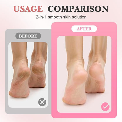 Electric Callus Remover, 2025 New 2-in-1 Electric Foot Callus Remover, Pedicure Tools for Feet, ElectricS Callus RemoverS for Feet, Foot Care for Men and Women (1pcs)