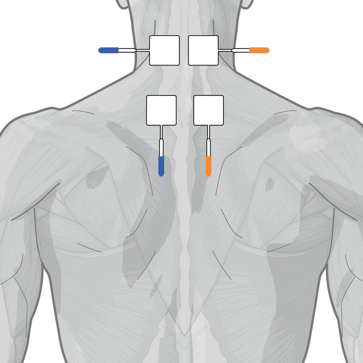 GLOBUS | Genesy S2 2 Channel Electrostimulator, 60 Physiotherapy Programs