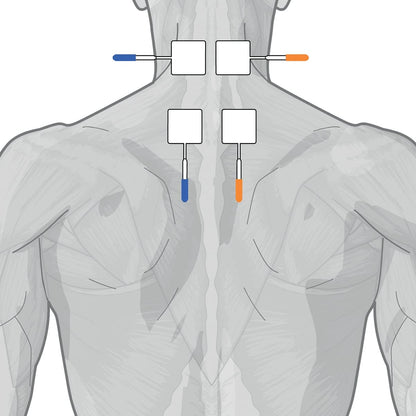 GLOBUS | Genesy S2 2 Channel Electrostimulator, 60 Physiotherapy Programs