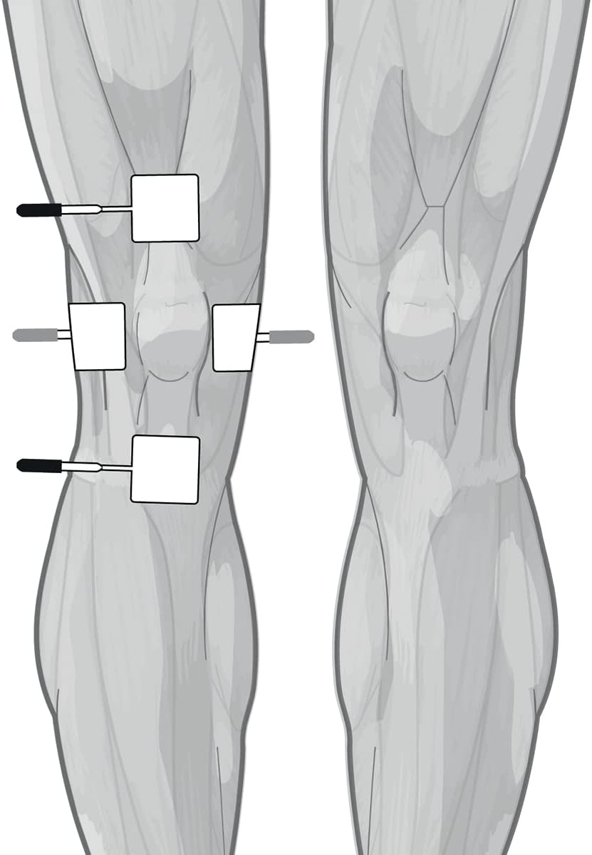 Globus | Genesy 3000, 4-Channel Electrostimulator with 423 Programs, Professional Use and Rehabilitation for Treatments of Musculoskeletal System Diseases