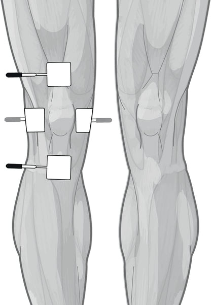 Globus | Genesy 3000, 4-Channel Electrostimulator with 423 Programs, Professional Use and Rehabilitation for Treatments of Musculoskeletal System Diseases