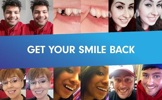 Temptooth #1 Seller Trusted Patented Temporary Tooth Replacement Product