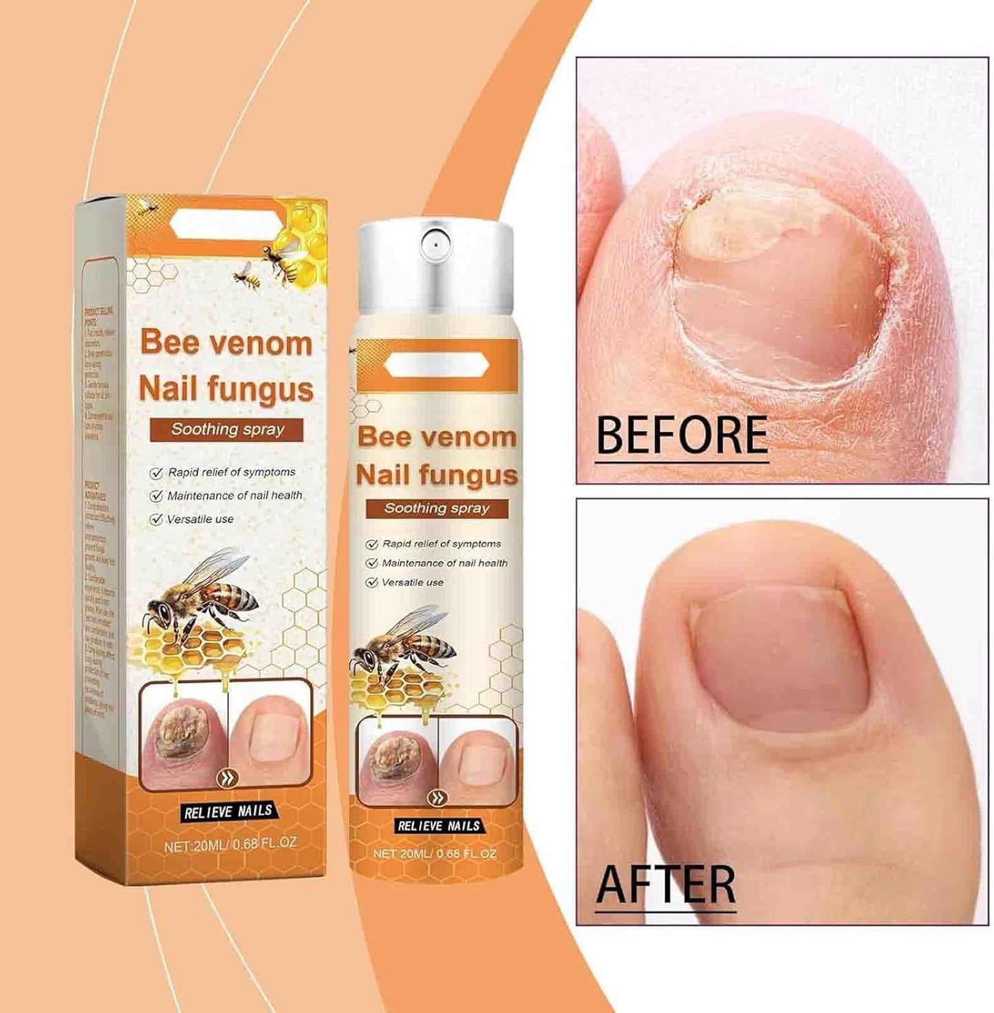 Bee Venom Nail Soothing Spray, Bee Venom Nail Care Spray, Bee Venom Spray for Women and Men (1pcs)