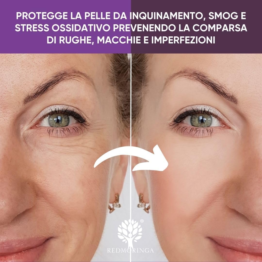 RedMoringa - Hyaluronic Acid Face Filler with 3 Molecular Weights, Anti-Wrinkle 99% Natural - Wrinkles Filler Face Serum with Moringa Extract - Clinically Tested - 30 ml
