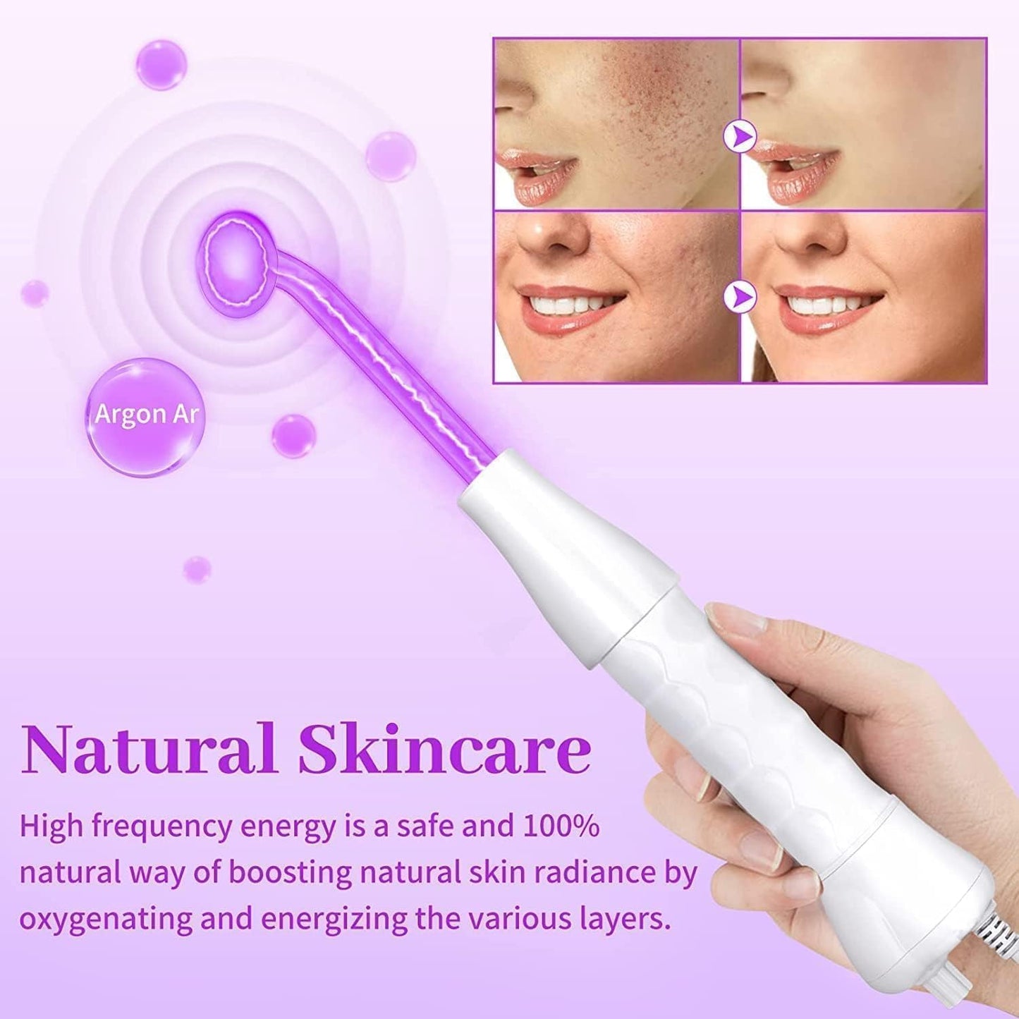 PFATURKHN Handheld Red Light Electrotherapy High Frequency Cosmetology Instrument,Portable 5 in 1 High Frequency Facial Machine,Anti-Aging Skin Care Device for Acne, Wrinkles & Hair Growth