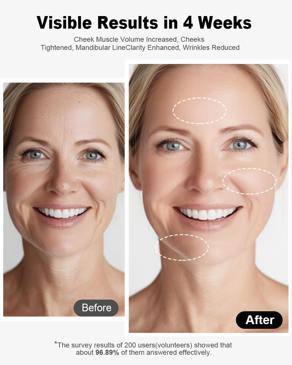 Radio Frequency Skin Tightening Device, 3-in-1 Microcurrent Facial Machine Face Massager LED Anti Aging Wrinkle Reduction, Enhanced Absorption, Radiance, Elasticity, Pore Care Korean Skin Care