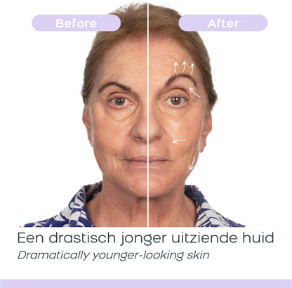 Dermawand Pro Skin Care Device