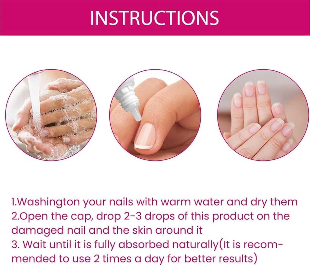 FungiGone Nail treatment,Fungigone Nail Fungus Removal,Fungal Nail Care Extra Strong Toe,Nail Repair Growth Treatment,Natural Nail Strengthener,Painless Fix And Renew Damaged,Broken Nails (2)
