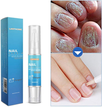 Iwähle Nail Care Nail Care Gel Rain Gel Bio-Pen Nail Care Pen Effective Fragile Nail Repair