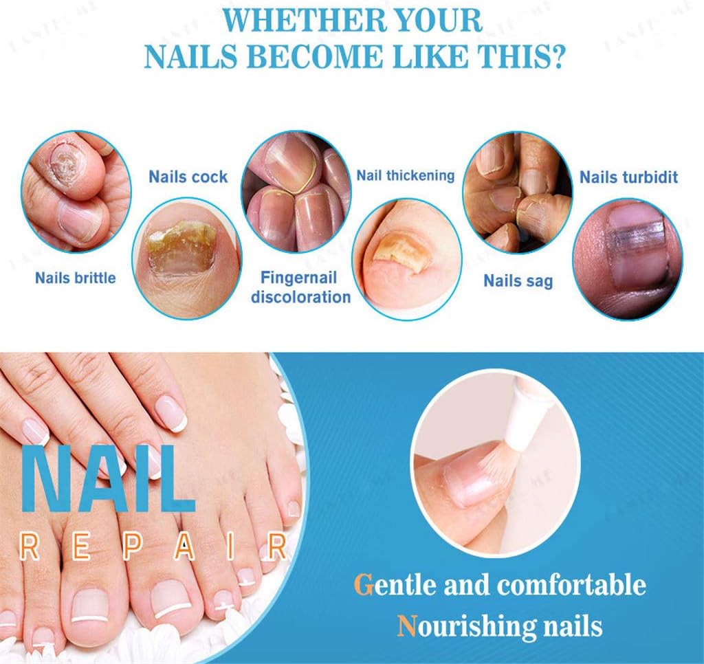 Iwähle Nail Care Nail Care Gel Rain Gel Bio-Pen Nail Care Pen Effective Fragile Nail Repair
