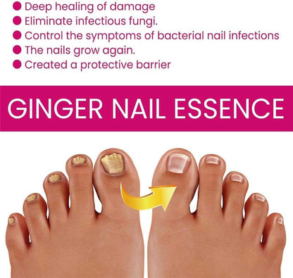 FungiGone Nail treatment,Fungigone Nail Fungus Removal,Fungal Nail Care Extra Strong Toe,Nail Repair Growth Treatment,Natural Nail Strengthener,Painless Fix And Renew Damaged,Broken Nails (2)