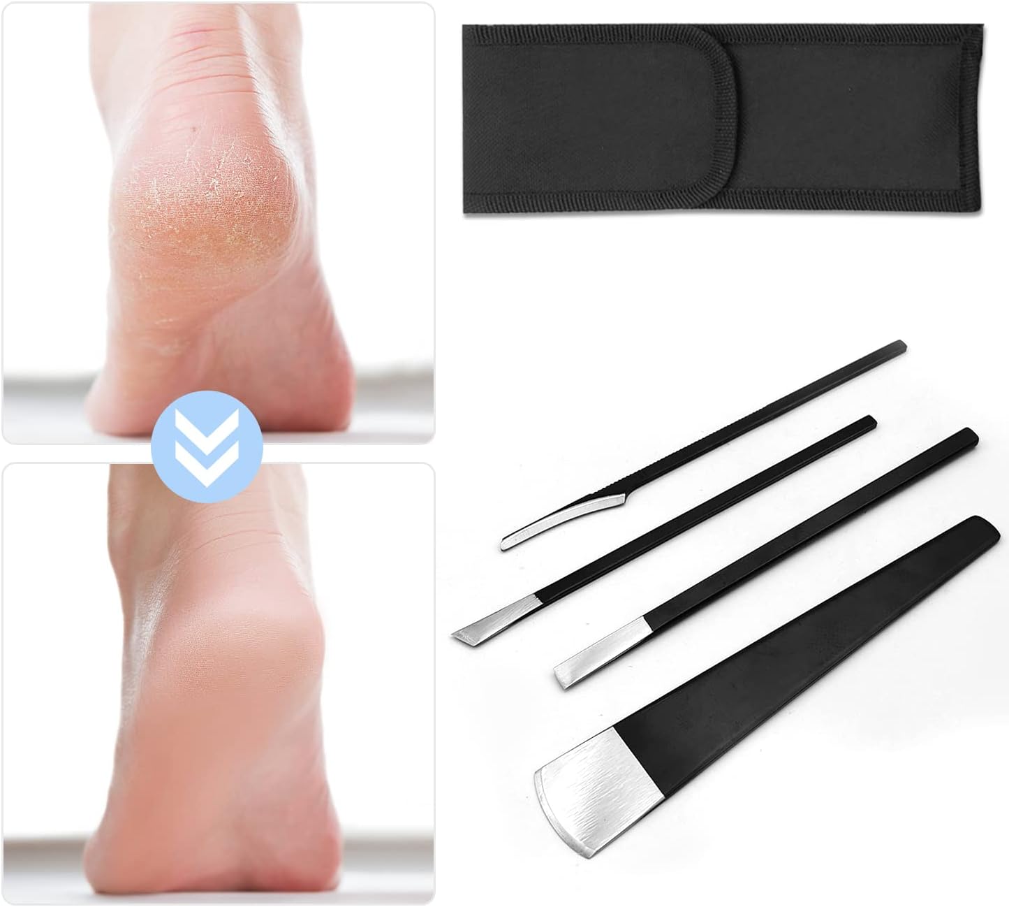 4 PCS Pedicure Knife Set Stainless Steel Ingrown Toenail Knife Correction Foot Scraper Clipper Pedicure Nail Remover Kit with Storage Bag for Calluses Beauty Salon Home Use Foot Care - Black